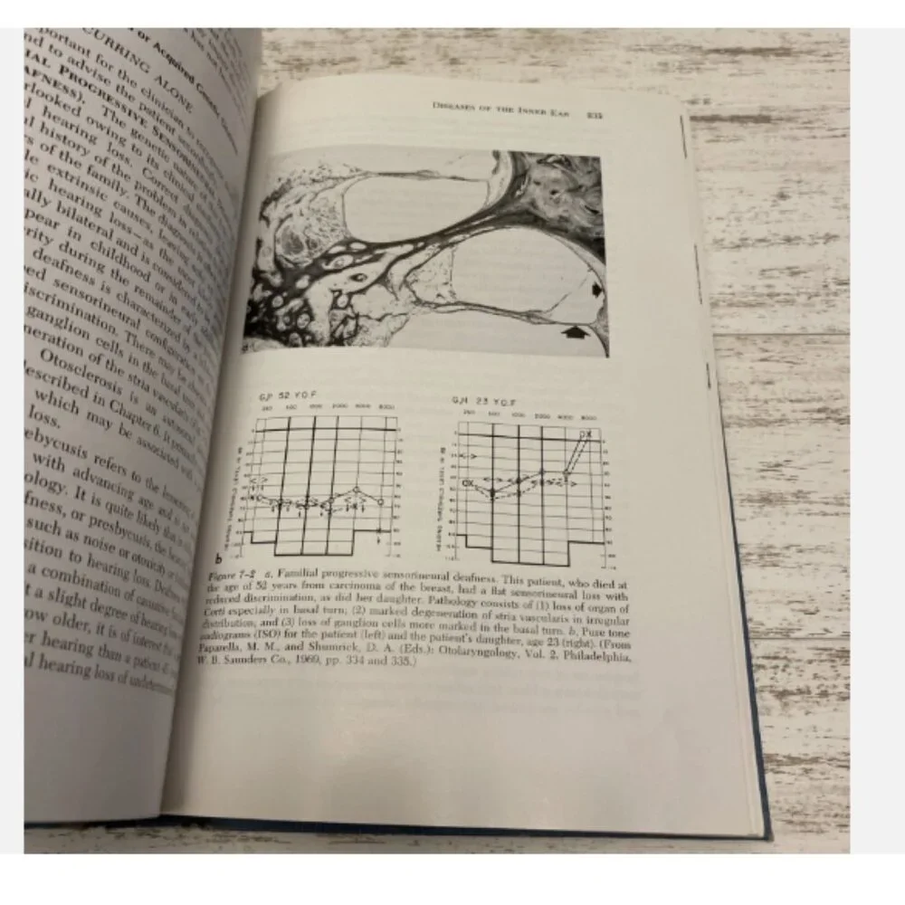 FUNDAMENTALS OF OTOLARYNGOLOGY Boies’s Adams Papaella 1978 Hardcover